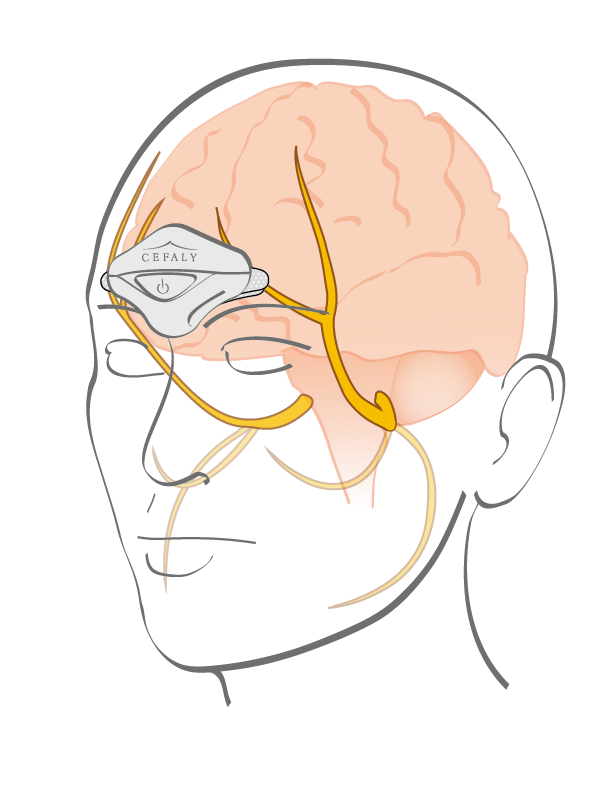 ic-trigeminal-nerve